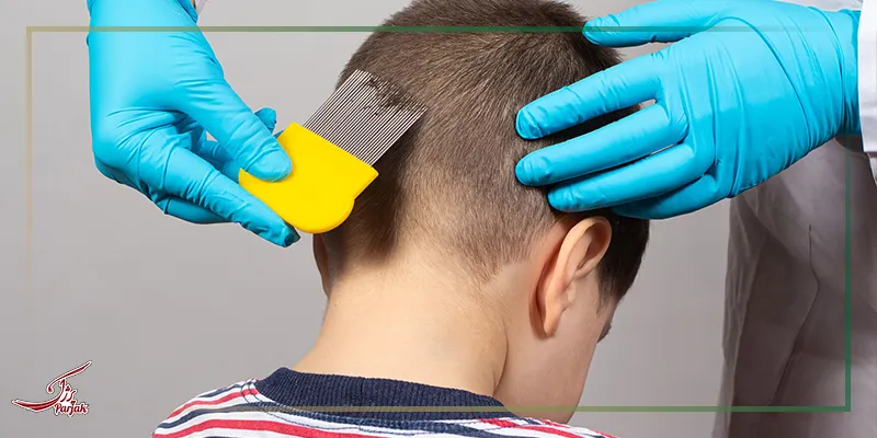 روش استفاده از شامپو ضد شپش